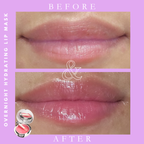 Overnight Lip Mask+ Hydrating Lip  Balm