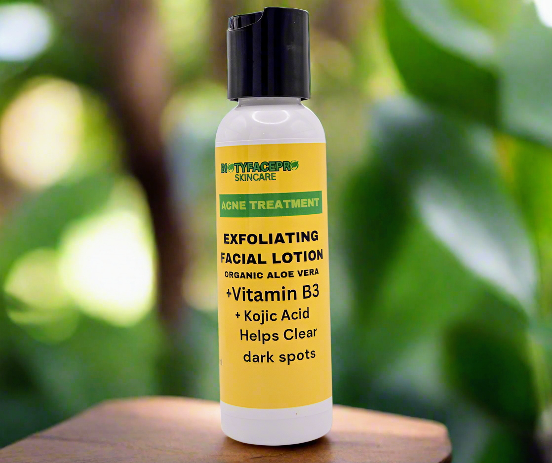 Acne Treatment Exfoliating Cream Lotion
