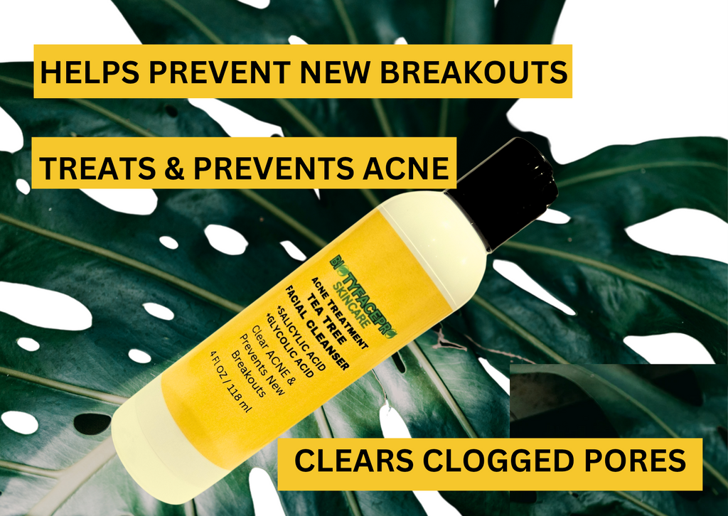 Acne Treatment KIT (4 Pieces) with Natural & Organic Ingredients - BIOTYFACEPRO SKINCARE 